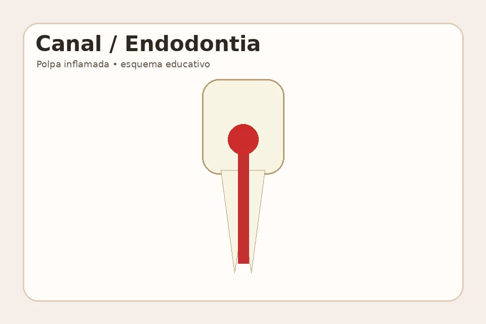 Canal / Endodontia