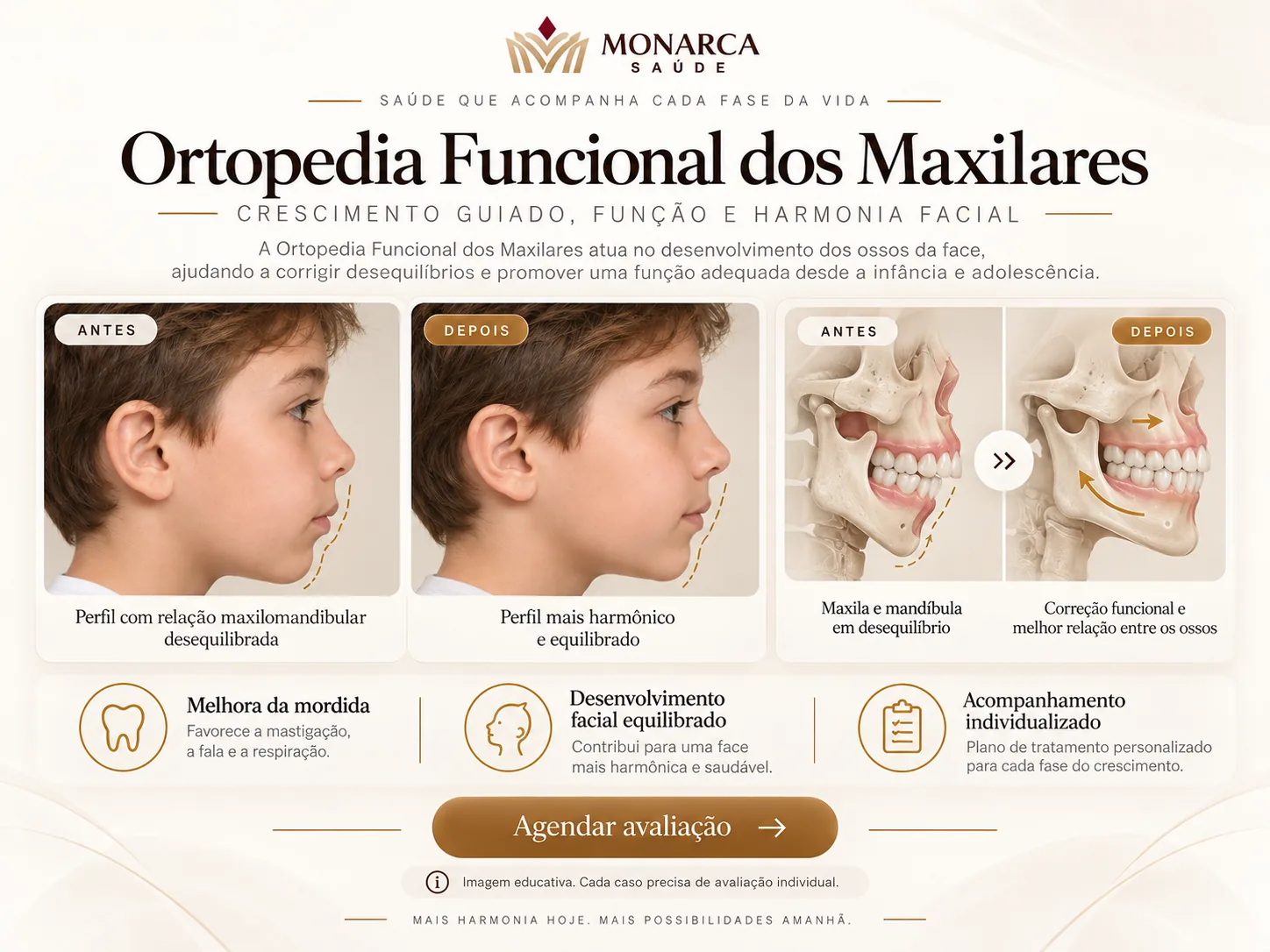 Exemplo visual educativo — Ortopedia Funcional