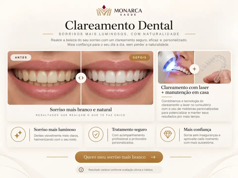Guia visual — Clareamento Dental