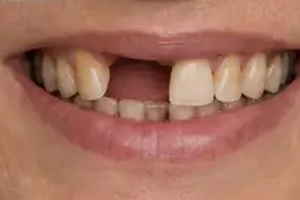 Representação visual educativa de Prótese Dentária