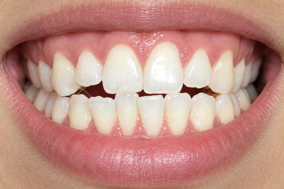 Odontopediatria