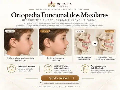 Exemplo visual educativo — Ortopedia Funcional
