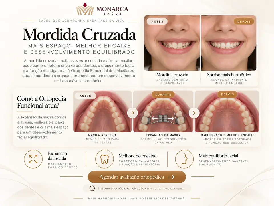 Simulação educativa de mordida cruzada e expansão maxilar
