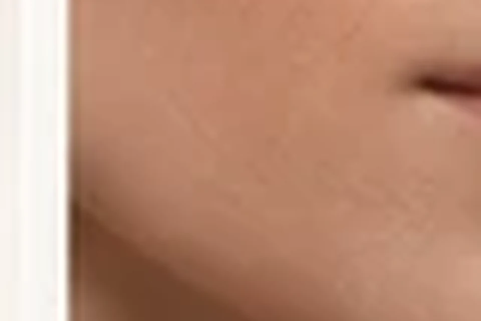 Exemplo visual educativo antes de Contorno de Mandíbula