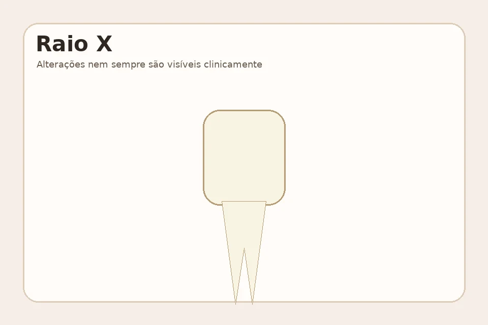 Exemplo visual educativo antes de Raio X Periapical