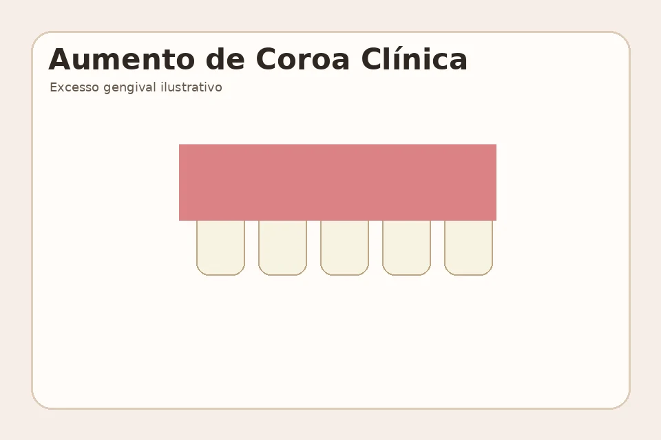 Exemplo visual educativo antes de Aumento de Coroa Clínica