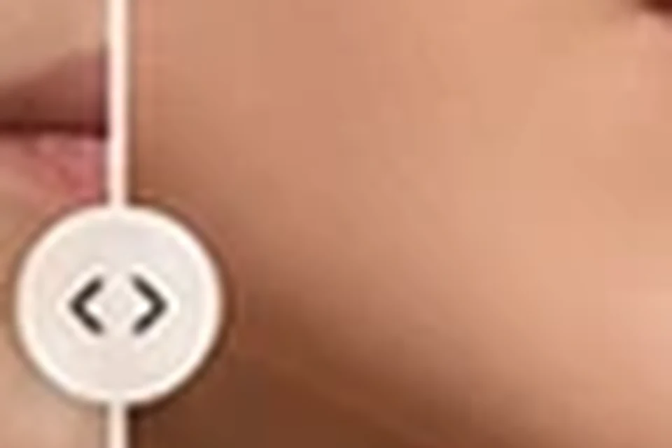 Exemplo visual educativo depois de Contorno de Mandíbula