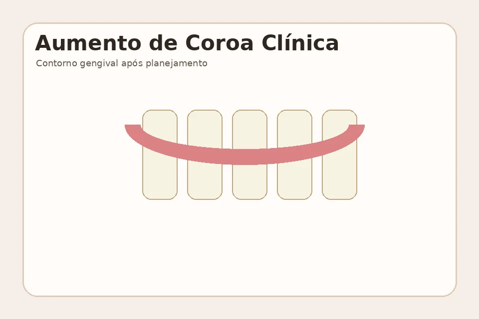 Exemplo visual educativo depois de Aumento de Coroa Clínica
